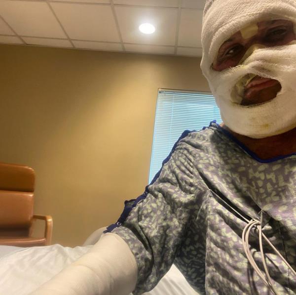 an injured nirschel