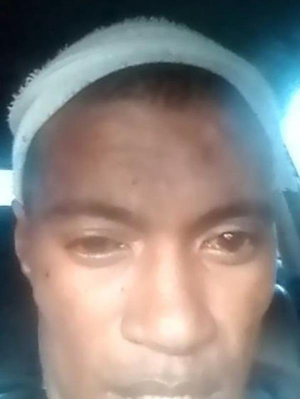 Milosh with a bandage around his head. 