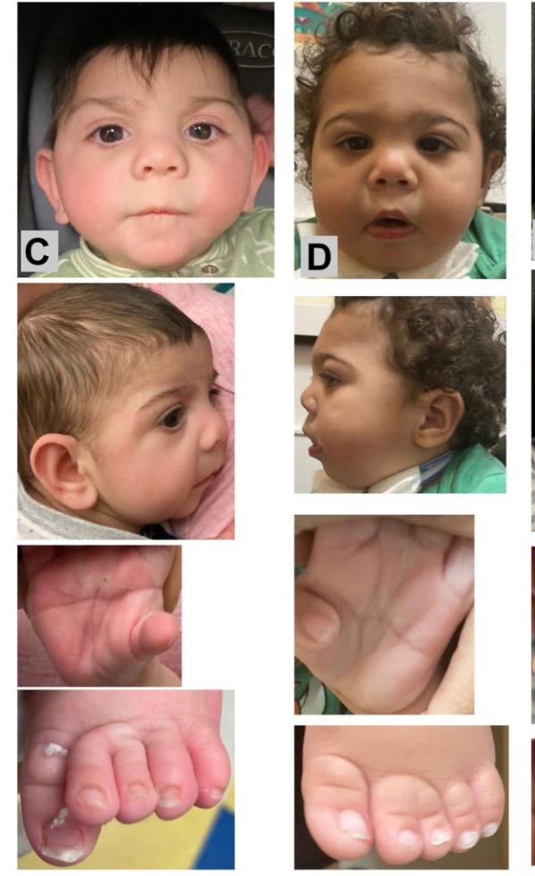 These babies have birth defects related to suspected fentanyl exposure. 
