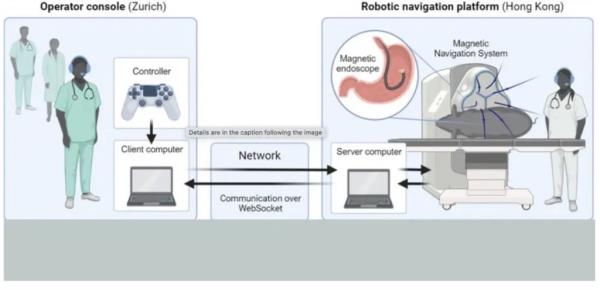graphic shows how surgeons use PlayStation co<em></em>ntroller for long-distance endoscopy