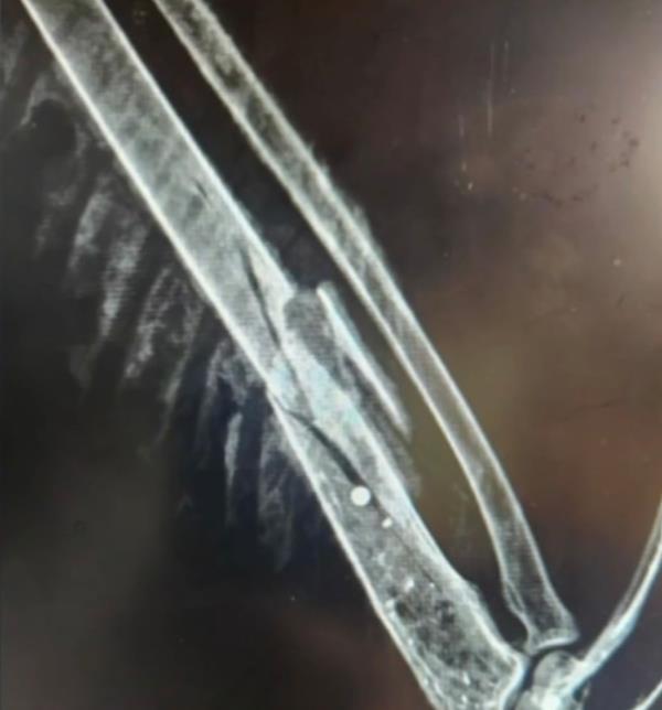 The bird of prey had two bullet wounds in her wing and one in her back