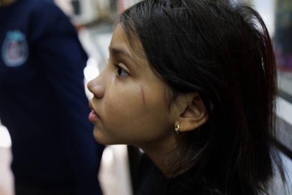 A scar is visible on Yuledy's cheek while she shops for food with her family near their home in Englewood, Nov. 6, 2023. Yuledy and her brother Pedro were both hurt after students hit them at school. 
