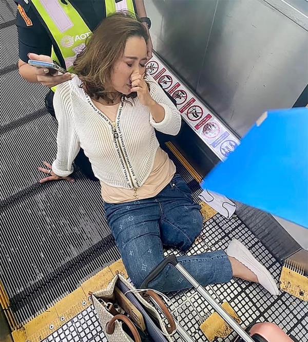 The woman after her leg was cut off.